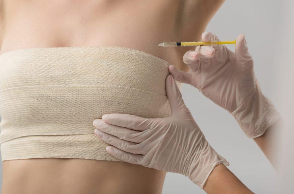Capsular Contracture