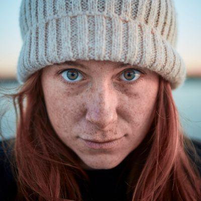 10 Top Winter Skin Care Tips from a Dermatologist